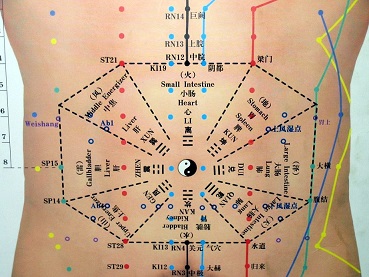 Acupuncture-korean.jpg